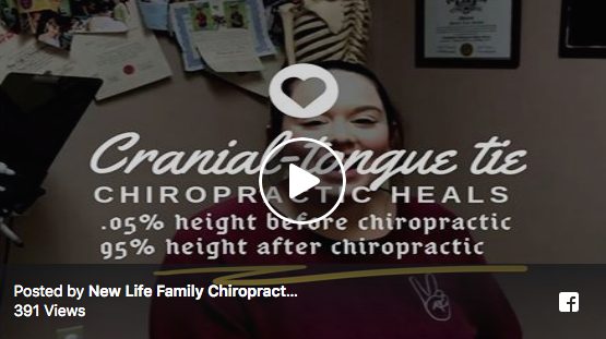 Tongue Tie Chiropractic